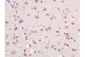 Formalin-fixed and paraffin embedded at brain labeled with Anti-RFX4 Polyclonal Antibody, Unconjugated (ABIN1386336) at 1:200 followed by conjugation to the secondary antibody and DAB staining (RFX4 Antikörper  (AA 101-200))