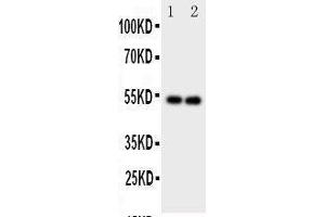 Anti-GABA A Receptor alpha 1 antibody, Western blotting Lane 1: Rat Brain Tissue Lysate Lane 2: Rat Brain Tissue Lysate