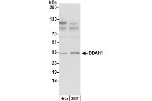 Western Blotting (WB) image for anti-Dimethylarginine Dimethylaminohydrolase 1 (DDAH1) (AA 175-225) antibody (ABIN7452930)