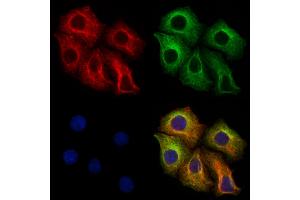 ABIN6265121 and ABIN6273320 staining Hela cells by IF/ICC. (SLC25A46 Antikörper  (N-Term))