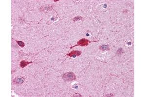 WNT5A antibody was used for immunohistochemistry at a concentration of 4-8 ug/ml. (WNT5A Antikörper  (Middle Region))