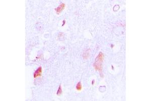 Immunohistochemical analysis of HCCS staining in human brain formalin fixed paraffin embedded tissue section. (HCCS Antikörper  (Center))