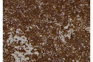 ABIN6273521 at 1/100 staining Mouse spleen tissue by IHC-P.