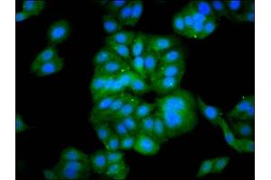 Immunofluorescence staining of HepG2 cells with ABIN7165258 at 1:133, counter-stained with DAPI. (DEPP1 (AA 57-174) Antikörper)