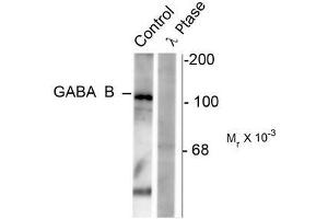 Image no. 1 for anti-gamma-aminobutyric Acid (GABA) B Receptor, 1 (GABBR1) (pSer923) antibody (ABIN372645) (GABBR1 Antikörper  (pSer923))