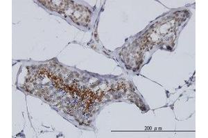 Image no. 1 for anti-A Kinase (PRKA) Anchor Protein 4 (AKAP4) (AA 1-101) antibody (ABIN599074) (AKAP4 Antikörper  (AA 1-101))