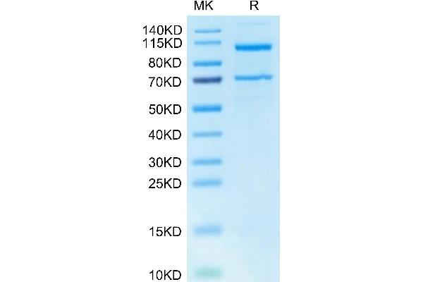 C5 Protein (AA 19-1676) (His tag)