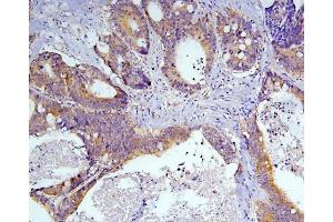 IHC analysis of Caspase-3 using anti-Caspase-3 antibody (ABIN6719555).