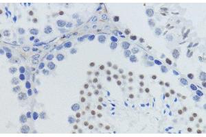 Immunohistochemistry (Paraffin-embedded Sections) (IHC (p)) image for anti-Histone H4 (meLys20) antibody (ABIN7260398)