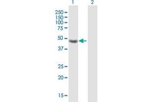 Western Blot analysis of CRELD1 expression in transfected 293T cell line by CRELD1 MaxPab polyclonal antibody. (CRELD1 Antikörper  (AA 1-422))