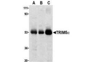 Western blot analysis of TRIM5 alpha expression in human stomach (A), thymus (B), and uterus (C) cell lysate with this product at 2 μg /ml. (TRIM5 Antikörper  (C-Term, Isoform alpha))