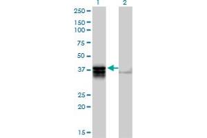 Western Blot analysis of TRDD3 expression in transfected 293T cell line by TRDD3 MaxPab polyclonal antibody. (TRDD3 Antikörper  (AA 1-296))
