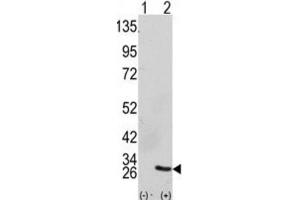 Western Blotting (WB) image for anti-Growth Factor Receptor-Bound Protein 2 (GRB2) antibody (ABIN3002593) (GRB2 Antikörper)
