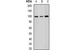 Western blot analysis of SAP145 expression in Hela (A), MCF7 (B), mouse testis (C) whole cell lysates.