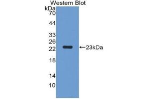 Detection of Recombinant PGLYRP1, Rat using Polyclonal Antibody to Peptidoglycan Recognition Protein 1 (PGLYRP1) (PGLYRP1 Antikörper  (AA 18-183))