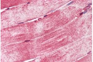 Human Skeletal Muscle (formalin-fixed, paraffin-embedded) stained with DNAJA3 antibody ABIN337354 at 10 ug/ml followed by biotinylated goat anti-rabbit IgG secondary antibody ABIN481713, alkaline phosphatase-streptavidin and chromogen.