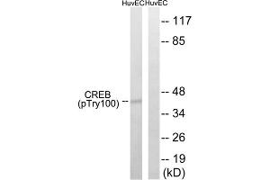 Western blot analysis of extracts from HUVEC cells, treated with etoposide (25uM, 24hours), using CREB (Phospho-Thr100) antibody. (CREB1 Antikörper  (pThr100))