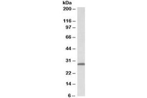 Western blot testing of human skin lysate with 14-3-3 sigma antibody at 0. (14-3-3 sigma/SFN Antikörper)