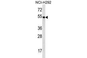 TBC1D3E Antibody (C-term) western blot analysis in NCI-H292 cell line lysates (35µg/lane). (TBC1D3E (AA 497-527), (C-Term) Antikörper)