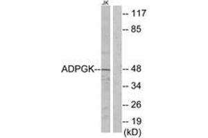 Western blot analysis of extracts from Jurkat cells, using ADPGK Antibody.