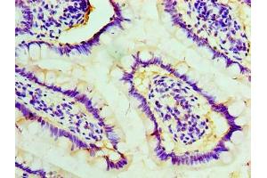 Immunohistochemistry of paraffin-embedded human small intestine tissue using ABIN7170819 at dilution of 1:100 (STIP1 Antikörper  (AA 1-543))