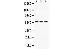 Western blot analysis of ALDH1B1 expression in rat liver extract ( Lane 1), mouse liver extract ( Lane 2) and HELA whole cell lysates ( Lane 3).