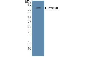 Detection of Recombinant IRF2, Mouse using Polyclonal Antibody to Interferon Regulatory Factor 2 (IRF2) (IRF2 Antikörper  (AA 1-349))