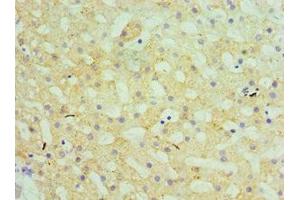 Immunohistochemistry of paraffin-embedded human liver tissue using ABIN7154176 at dilution of 1:100