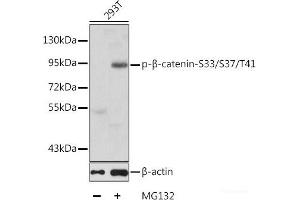 Western blot analysis of extracts of 293T cells using Phospho-β-catenin(S33/S37/T41) Polyclonal Antibody. (beta Catenin Antikörper  (pSer33, pSer37, pThr41))