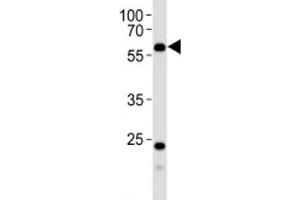 Western blot analysis of lysate from human kidney tissue using PFKFB3 antibody at 1:1000. (PFKFB3 Antikörper  (AA 454-484))
