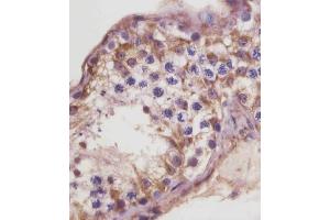 Immunohistochemistry (Paraffin-embedded Sections) (IHC (p)) image for anti-Transforming Growth Factor, beta Receptor III (TGFBR3) (AA 285-319) antibody (ABIN6243319)