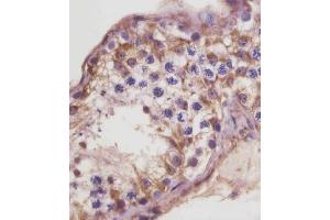(ABIN6243319 and ABIN6578857) staining TGFBR3 in human testis tissue sections by Immunohistochemistry (IHC-P - paraformaldehyde-fixed, paraffin-embedded sections). (TGFBR3 Antikörper  (AA 285-319))