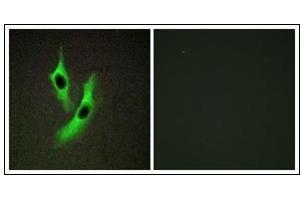Immunofluorescence analysis of HeLa cells, using STEAP4 Antibody. (STEAP4 Antikörper)