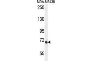 VPS52 Antikörper  (C-Term)