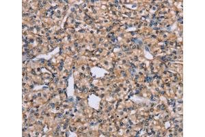 Immunohistochemistry (IHC) image for anti-ADAM Metallopeptidase Domain 29 (ADAM29) antibody (ABIN2427053) (ADAM29 Antikörper)