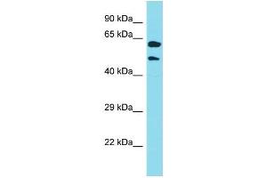 Western Blotting (WB) image for anti-Keratin 39 (KRT39) (N-Term) antibody (ABIN2791629) (Keratin 39 (KRT39) (N-Term) Antikörper)