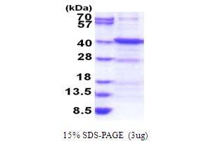SDS-PAGE (SDS) image for Ankyrin Repeat, Family A (RFXANK-Like), 2 (ANKRA2) (AA 1-313) protein (His tag) (ABIN5778071) (ANKRA2 Protein (AA 1-313) (His tag))