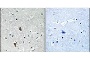 Immunohistochemistry analysis of paraffin-embedded human brain tissue, using OXR1 Antibody. (OXR1 Antikörper  (AA 472-521))