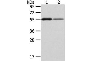 Gel: 8 % SDS-PAGE, Lysate: 40 μg, Lane 1-2: Human thyroid cancer and normal stomach tissue, Primary antibody: ABIN7193074(XKR3 Antibody) at dilution 1/200 dilution, Secondary antibody: Goat anti rabbit IgG at 1/8000 dilution, Exposure time: 2 minutes (XKR3 Antikörper)