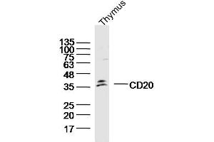 Western Blotting (WB) image for anti-Membrane-Spanning 4-Domains, Subfamily A, Member 1 (MS4A1) (AA 151-250) antibody (ABIN4999467)