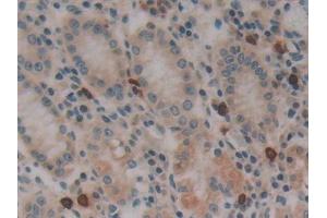 Immunohistochemistry (IHC) image for anti-Dynamin 2 (DNM2) (AA 533-731) antibody (ABIN7433204)
