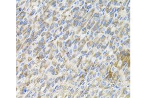 Immunohistochemistry of paraffin-embedded Mouse stomach using MBL2 Polyclonal Antibody (MBL2 Antikörper)