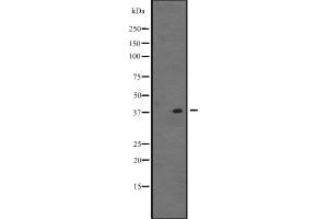 Western blot analysis of VSX1 expression in K562 cell line lysate ;,The lane on the left is treated with the antigen-specific peptide.