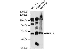 Western blot analysis of extracts of various cell lines, using TH antibody (ABIN7269714) at 1:1000 dilution. (PRKRIR Antikörper  (AA 1-300))