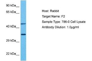 Western Blotting (WB) image for anti-Coagulation Factor II (thrombin) (F2) (Middle Region) antibody (ABIN2776976)