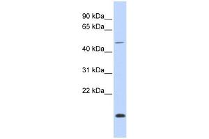 WB Suggested Anti-FOXN3 Antibody Titration:  0.