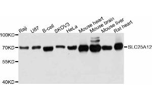 Western blot analysis of extracts of various cell lines, using SLC25A12 antibody (ABIN5998844) at 1:3000 dilution. (SLC25A12 Antikörper)