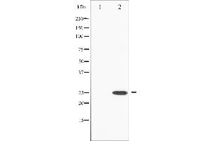 Western blot analysis of RhoA phosphorylation expression in HeLa whole cell lysates,The lane on the left is treated with the antigen-specific peptide. (RHOA Antikörper  (pSer188))