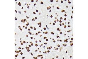 Immunohistochemistry of paraffin-embedded rat brain using Phospho-STA-Y694 antibody (ABIN6135328, ABIN6136272, ABIN6136273 and ABIN7101887) at dilution of 1:100 (40x lens). (STAT5A Antikörper  (pTyr694))