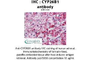 Image no. 1 for anti-Cytochrome P450, Family 26, Subfamily B, Polypeptide 1 (CYP26B1) (AA 160-396) antibody (ABIN1733454)